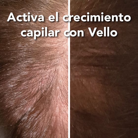 Antes y después Vello